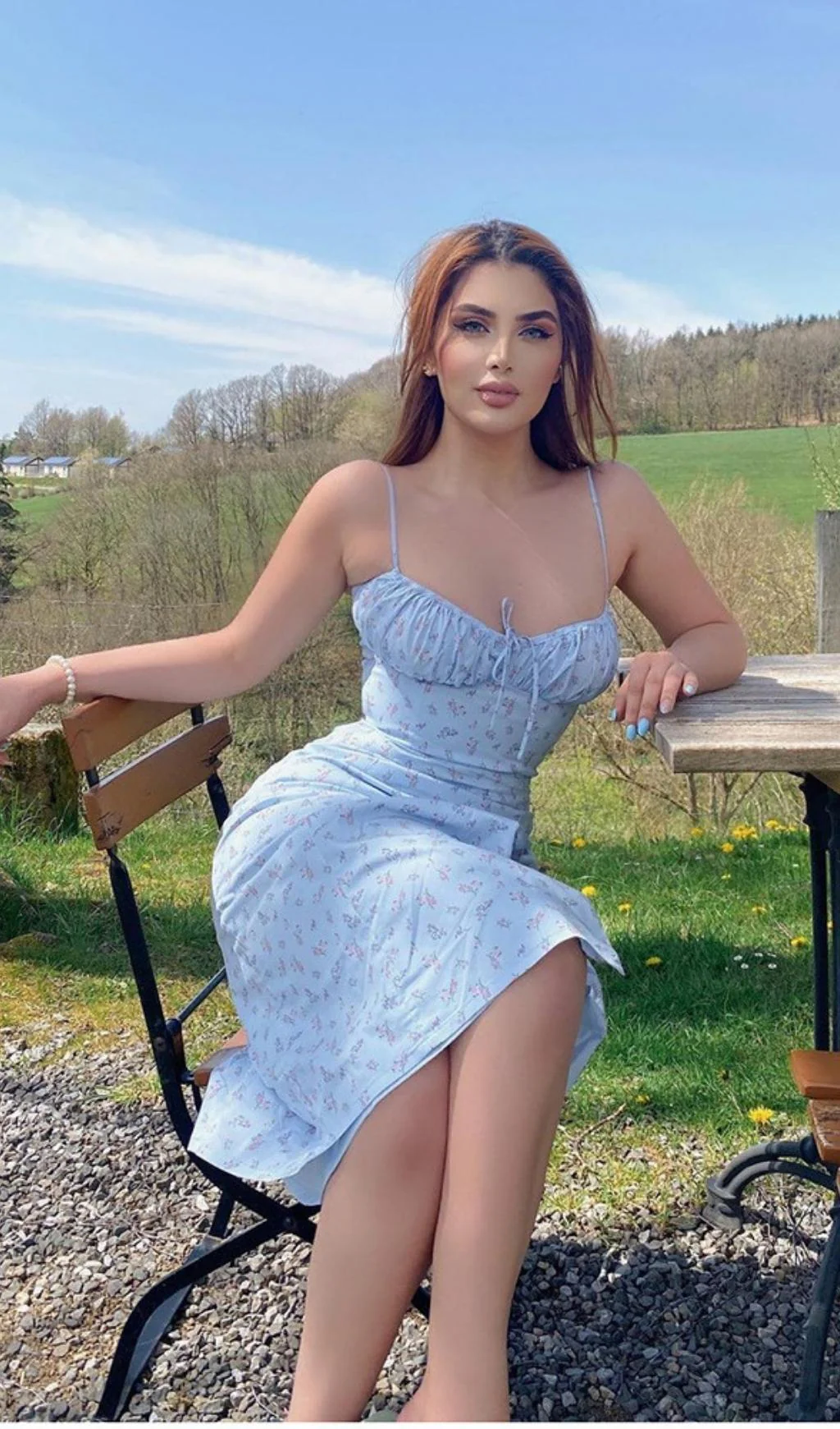 Sky Blue Suspender Print Dress - Image 4